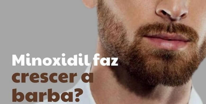 Minoxidil Faz Crescer a Barba?